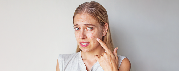 Skin protection